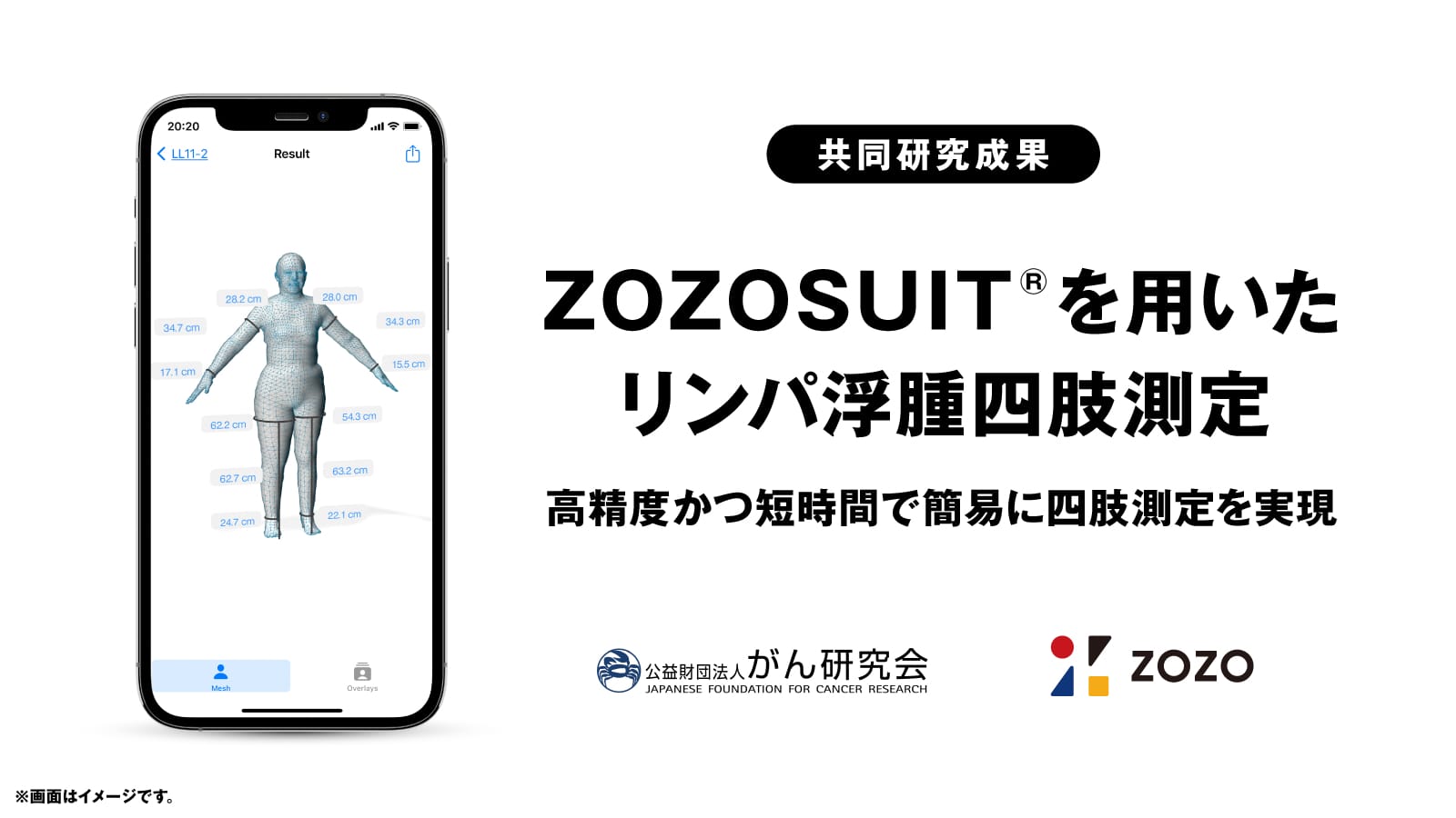 ZOZOSUIT®がリンパ浮腫四肢測定に有用か─ZOZOと有明病院の共同研究、がん術後のむくみ発見に貢献