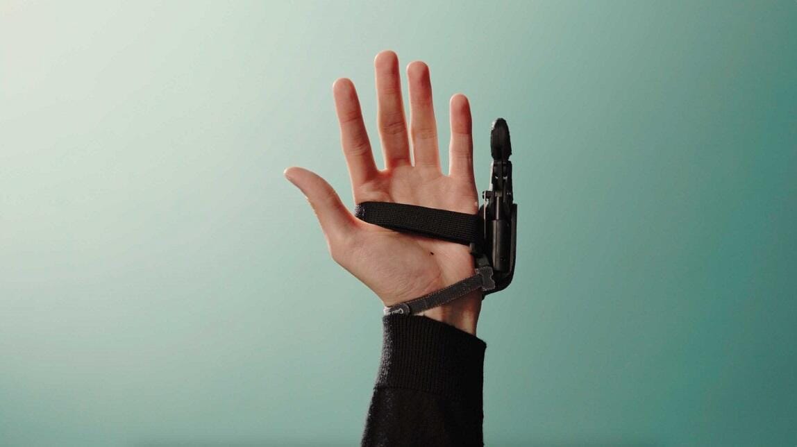 sixth finger