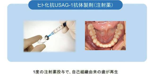 京大発ベンチャーが世界初、「歯を生やす薬」を開発中─2030年頃の実用化目指す
