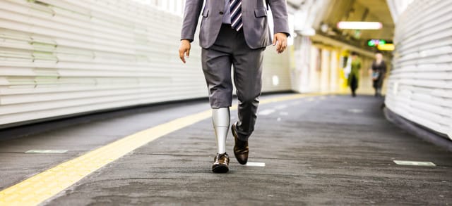 パワード義足を開発するBionicM株式会社、資金調達実施と新経営体制強化を発表