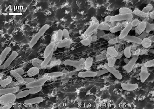 ゴミ問題の救世主、プラスチックを食べる細菌