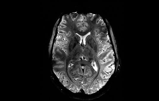 フランスCEAが開発、わずか4分で脳スキャンを完了する高性能MRI
