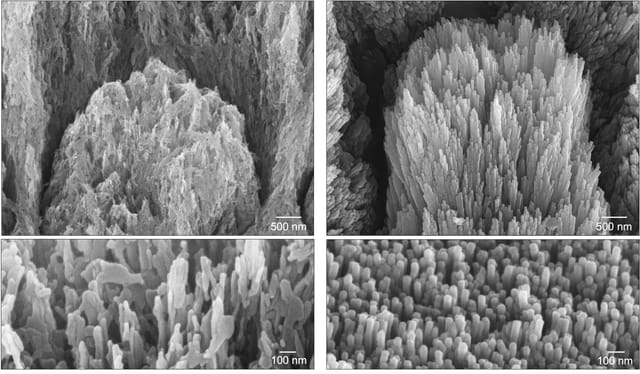 ノッティンガム大学、歯に塗るだけでエナメル質を再生する「ゲル」を開発