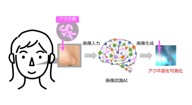 ライオン、画像認識AIでニキビの原因菌を可視化する技術を開発―東京電機大と共同研究、スマホ展開も想定