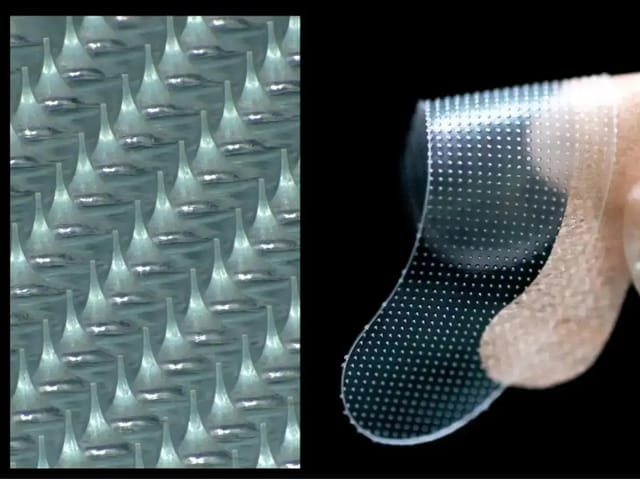 「皮膚に含まれる成分」でできた針が皮膚内で溶ける技術