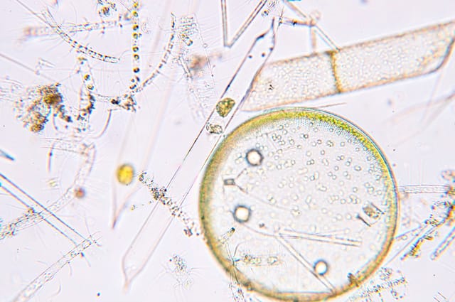石油と同じ成分を体内でつくりだす植物プランクトンを海洋研究開発機構が発見