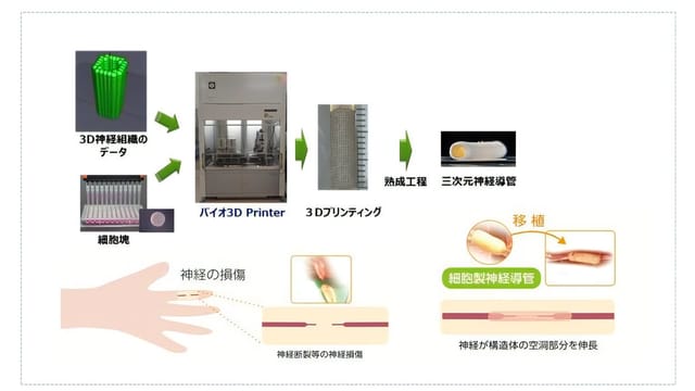 世界初、3Dプリンターで神経再生に成功─京大、作製した組織を移植で神経損傷を回復