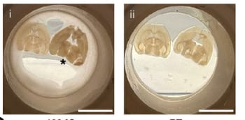 ドイツの研究チーム、マウスの脳をガラス化する凍結保存でマウスの海馬の回復を実証