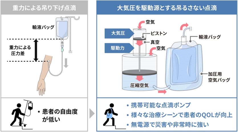 産総研と入江工研、「吊るさない点滴」を開発―医療機器としてPMDAに登録、在宅医療や災害現場に活用